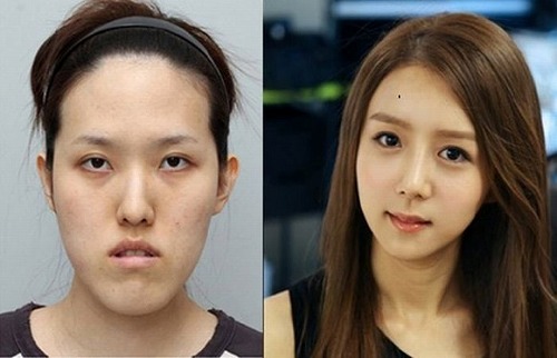 、韓国がほこる驚愕技術「美容整形手術」